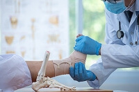 Causes and Signs of a Broken Ankle